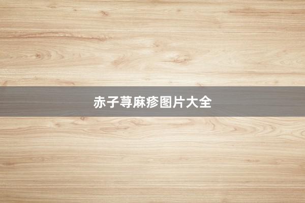 赤子荨麻疹图片大全